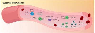 Neuro-Immunity and Gut Dysbiosis Drive Parkinson’s Disease-Induced Pain